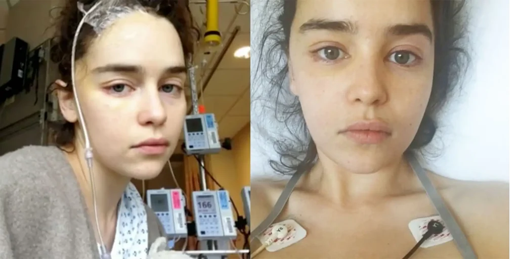 emilia clarke krankheit Zweites Aneurysma und erneute Operation